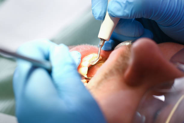 Best Emergency Dental Surgery in Odon, IN
