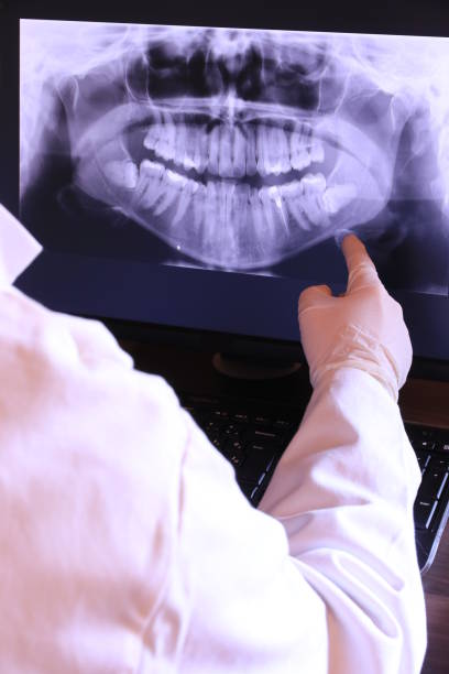 Best Emergency Tooth Extraction in Odon, IN