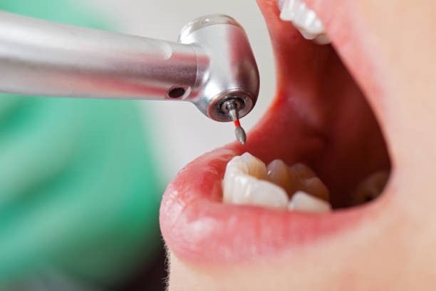 Best Weekend Emergency Dentist in Odon, IN